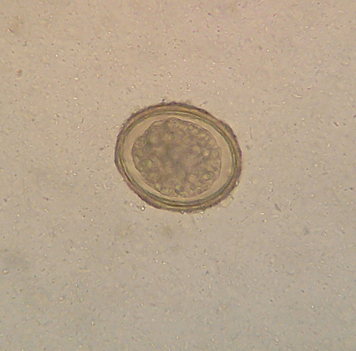 Huevo fértil del geohelminto 'Ascaris lumbricoides' visto al microscopio/J3D3, CC BY-SA 3.0 <https://creativecommons.org/licenses/by-sa/3.0>, via Wikimedia Commons